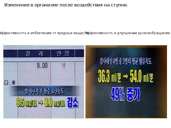 Изменения в организме после воздействия на ступни. Эффективность в избавлении от вредных веществ Эффективность